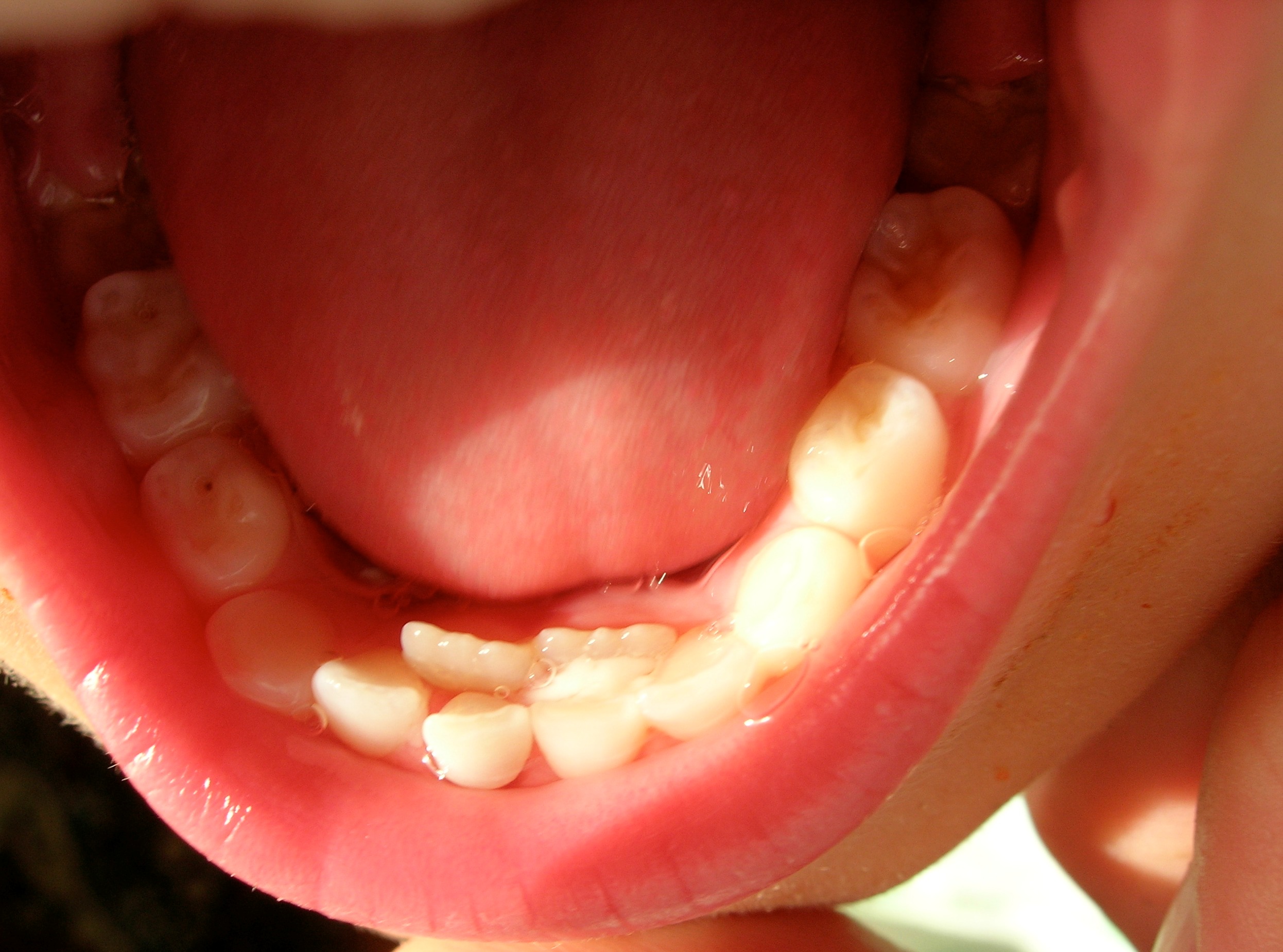 mouth